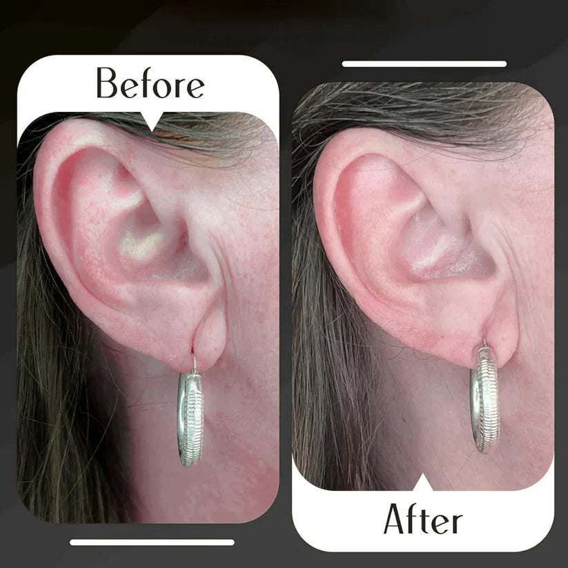 Premium Earlobe Support Patches (100 PCS)