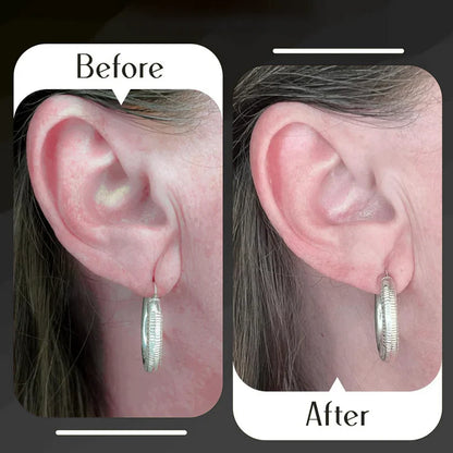 Premium Earlobe Support Patches (100 PCS)